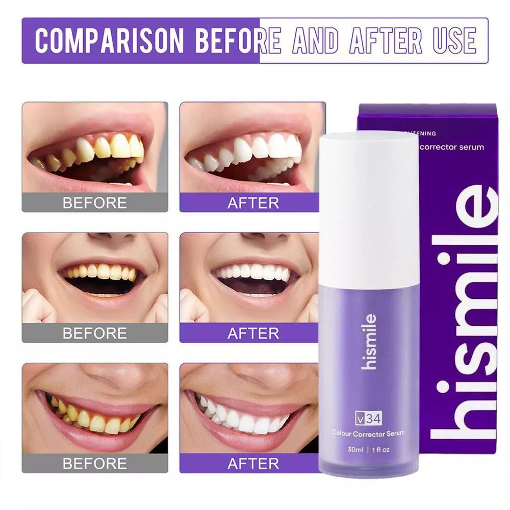 Unlock Your Brightest Smile ( 2,000+ Order Dispatched All Over Pakistan 🏆 )