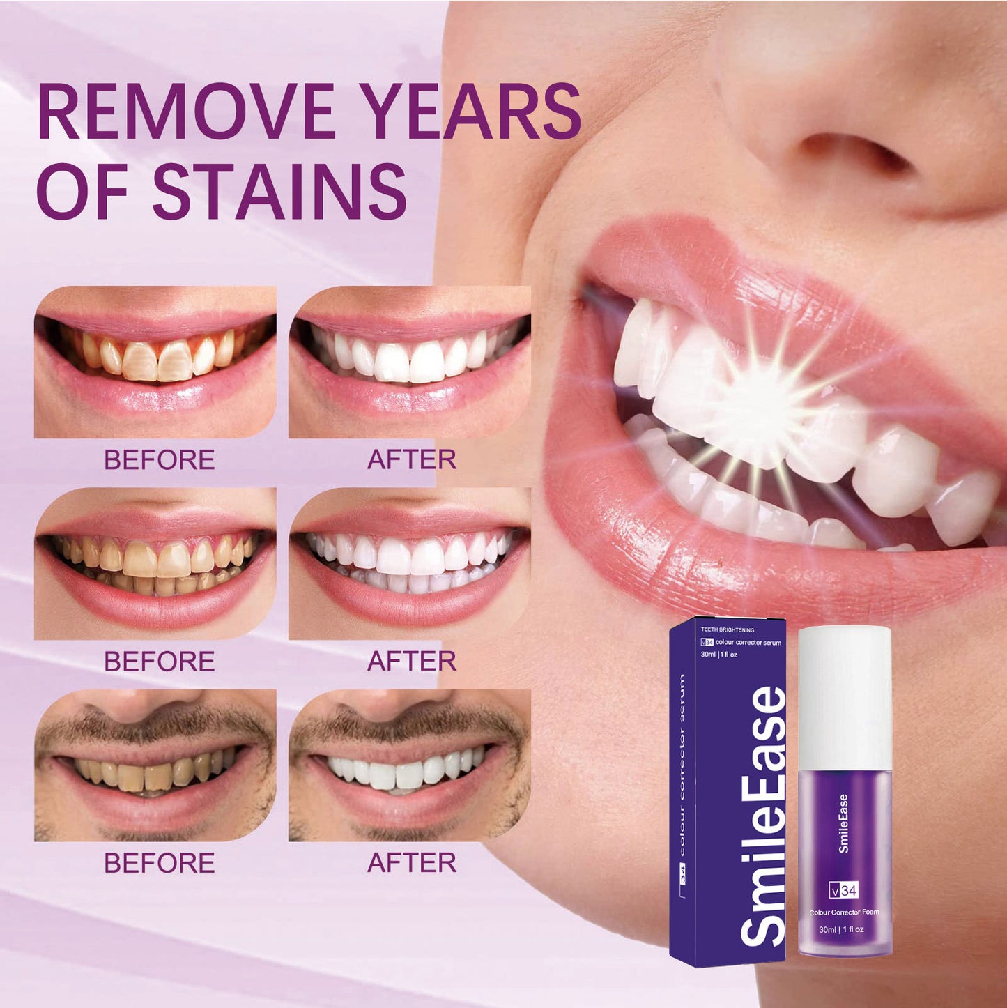 Unlock Your Brightest Smile ( 2,000+ Order Dispatched All Over Pakistan 🏆 )